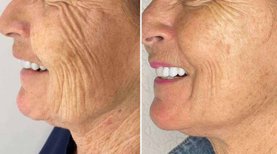 An image of Freelio's project ui