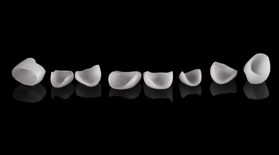 porcelain veneers