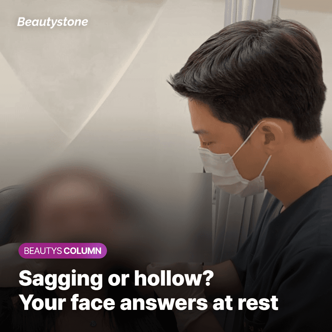 Comparing a sagging nasolabial fold with a hollow one
