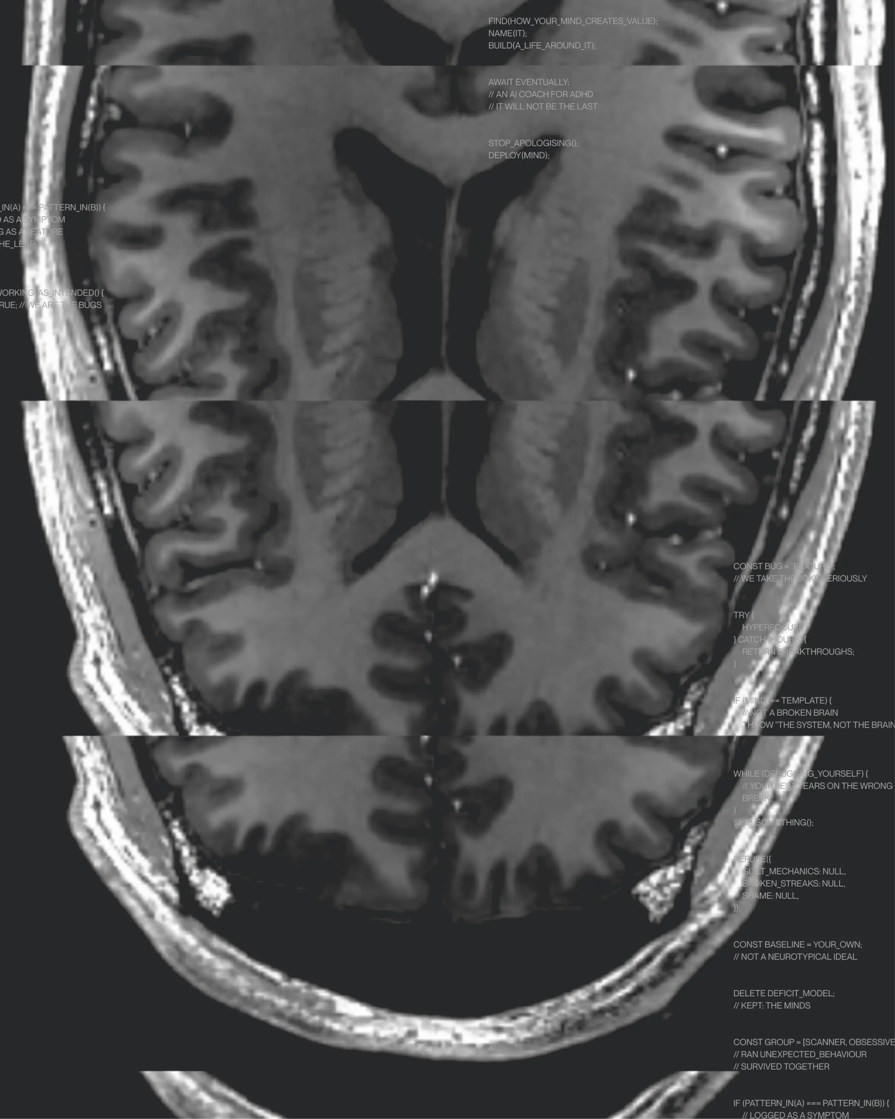 Brain MRI scan slices overlaid with small annotation text for Different Thinking