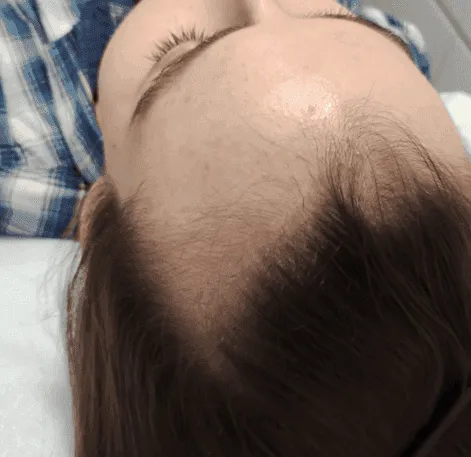 Hair Before