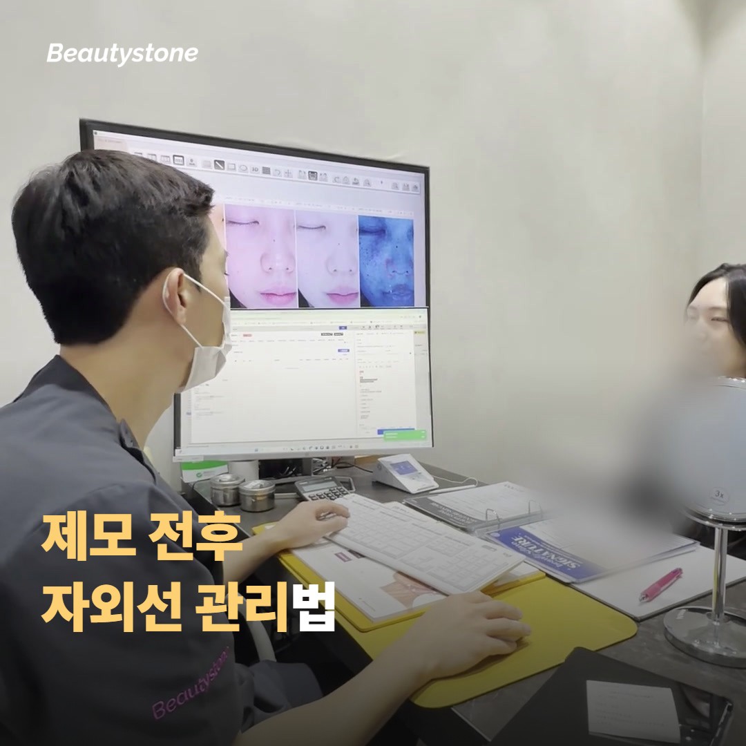 제모 전후 자외선 관리법