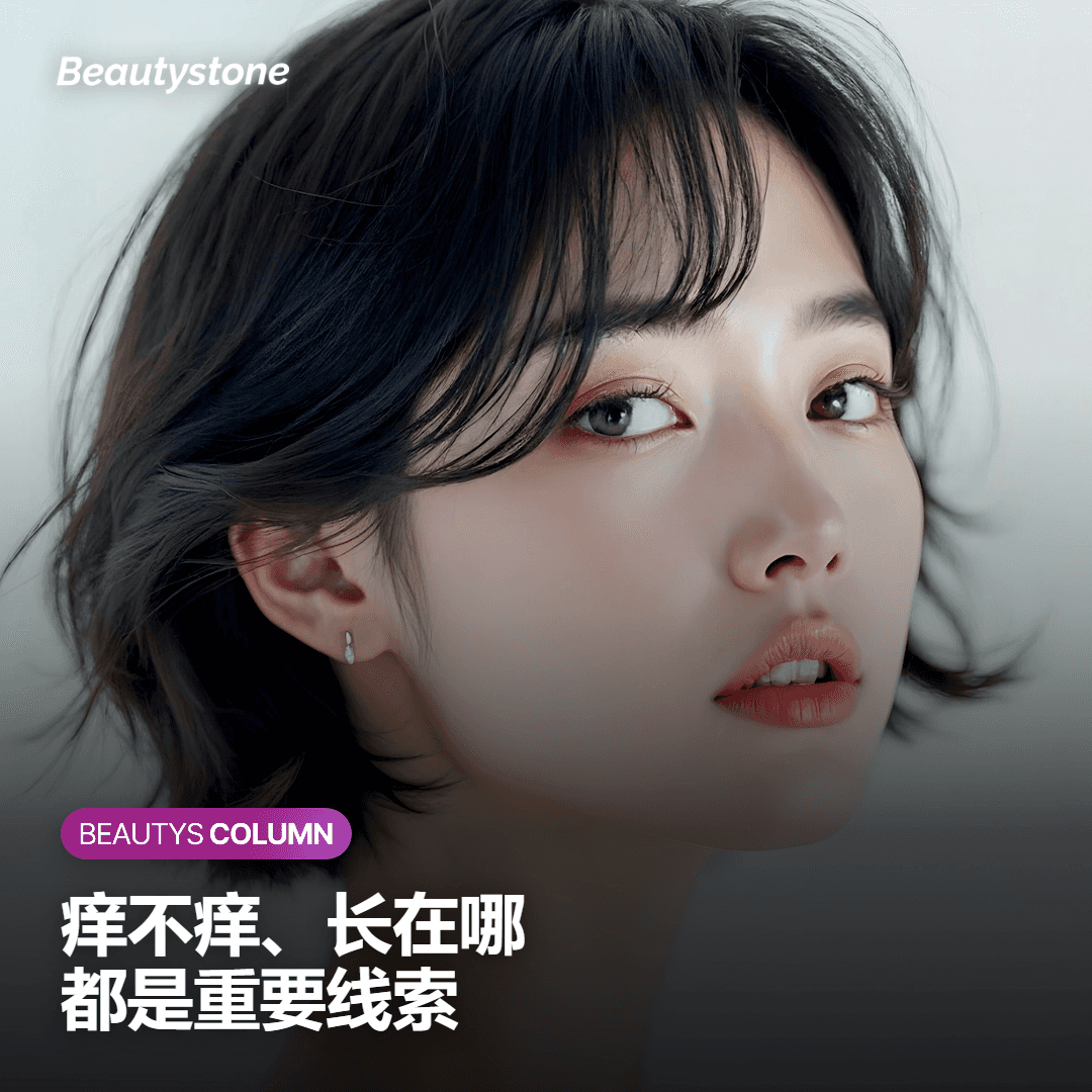 出现粉刺就是痤疮