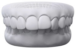 Overbite teeth