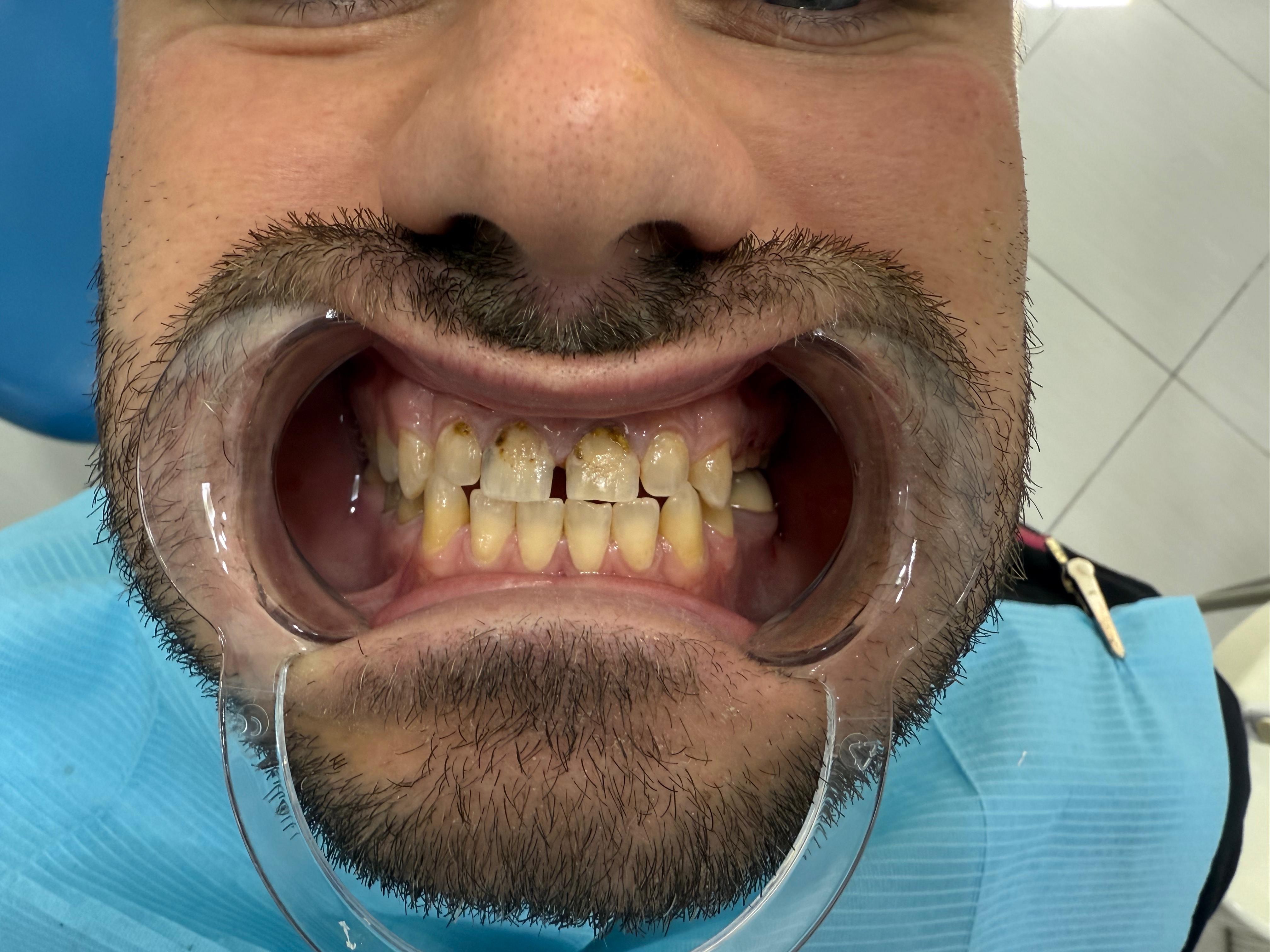 Before Image