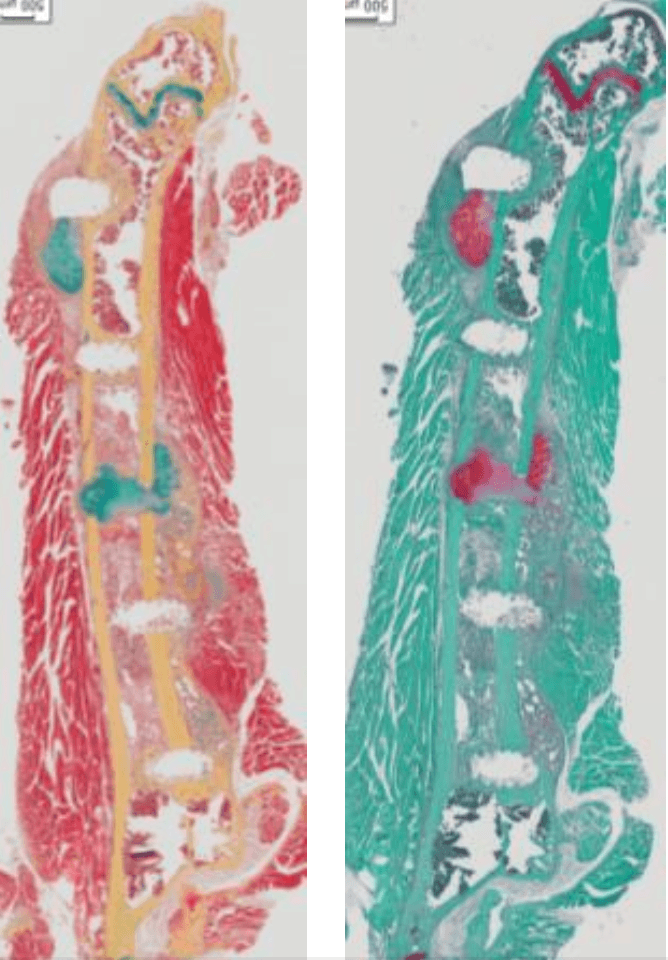 Two side-by-side images showcasing the same type of tissue for comparative analysis.