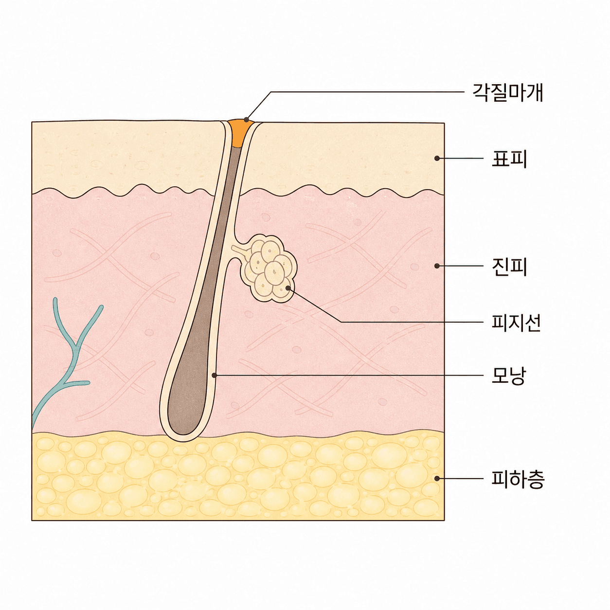 모공 입구가 막히면 안쪽에 쌓인 것이 빠져나가지 못해 작은 알갱이로 만져져요.