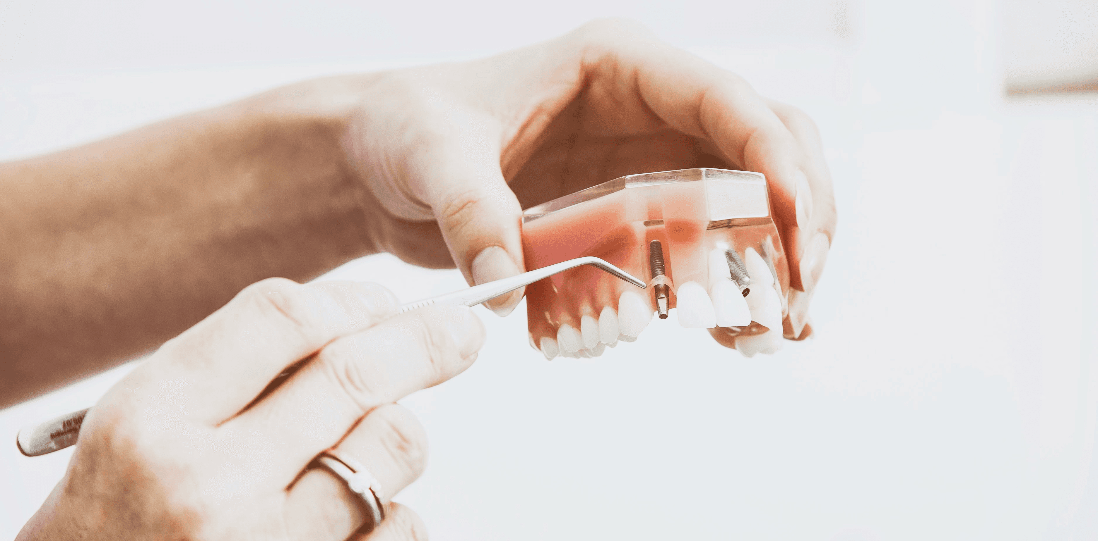 person wearing silver-colored ring while holding denture