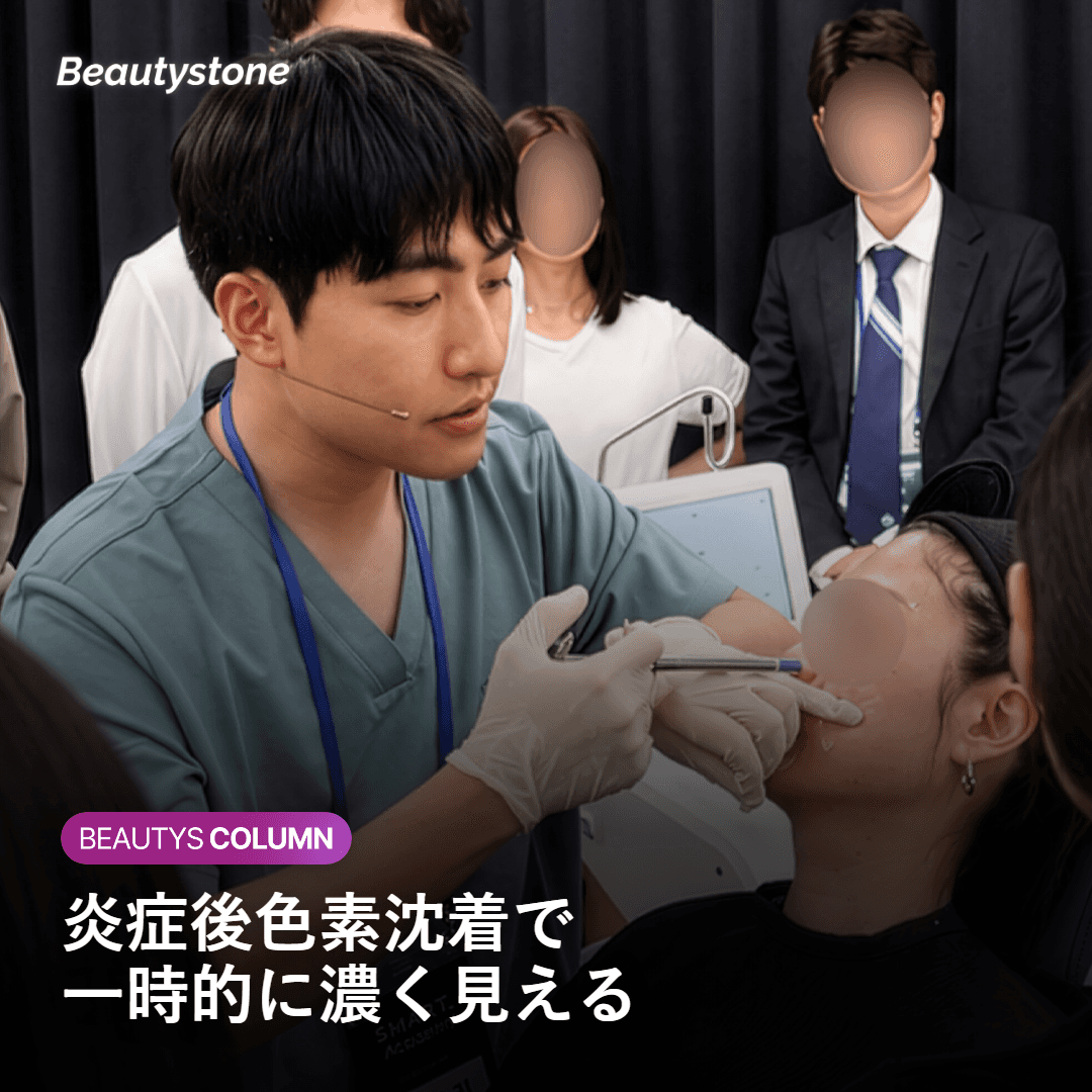 なぜ一時的に濃く見える・ムラになるのか