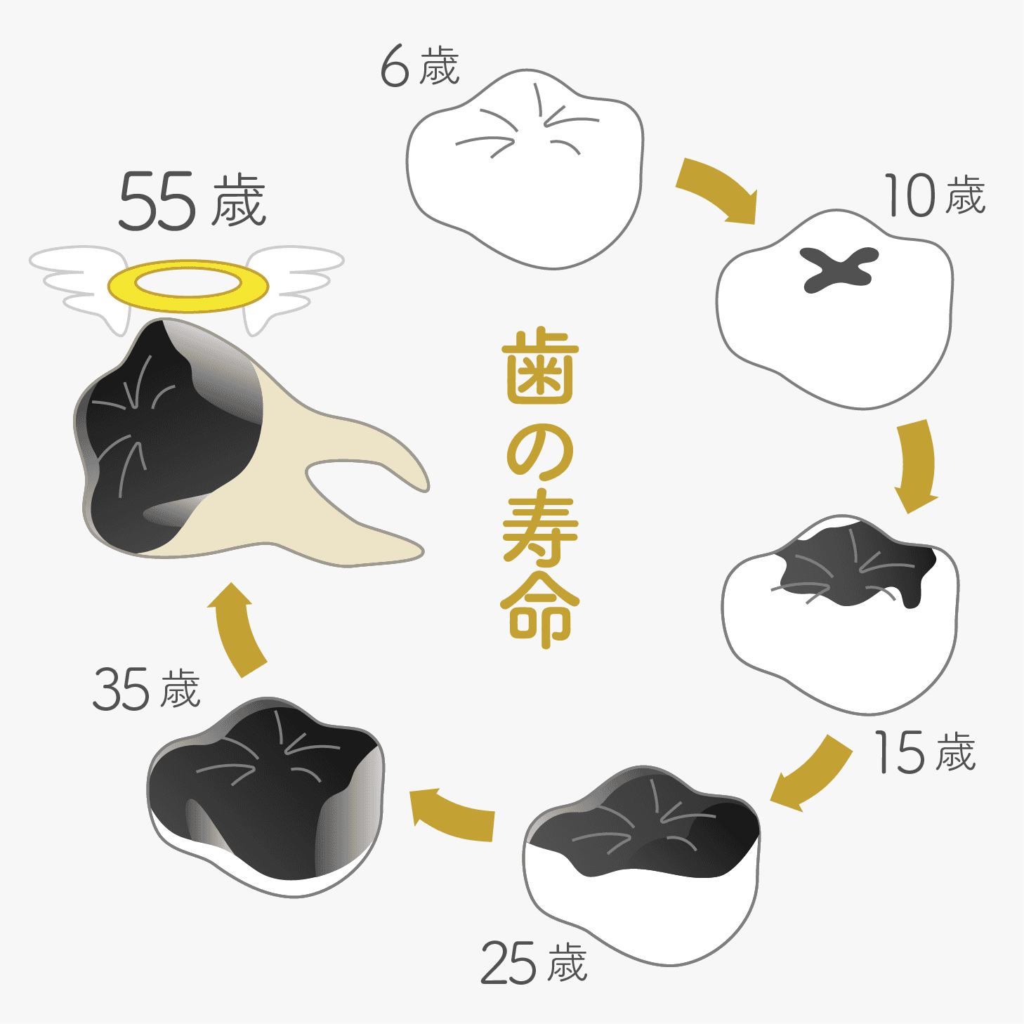 歯の寿命