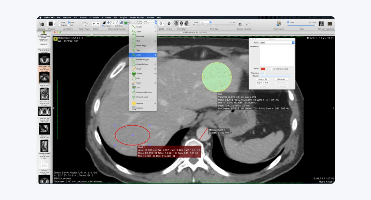 OsiriX: DICOM Viewer for macOS