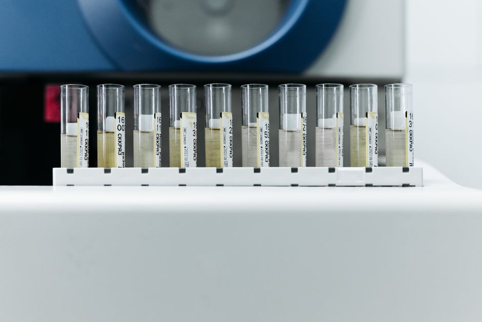 Exame Toxicológico na Primeira Habilitação no RS: Entenda o Que Muda