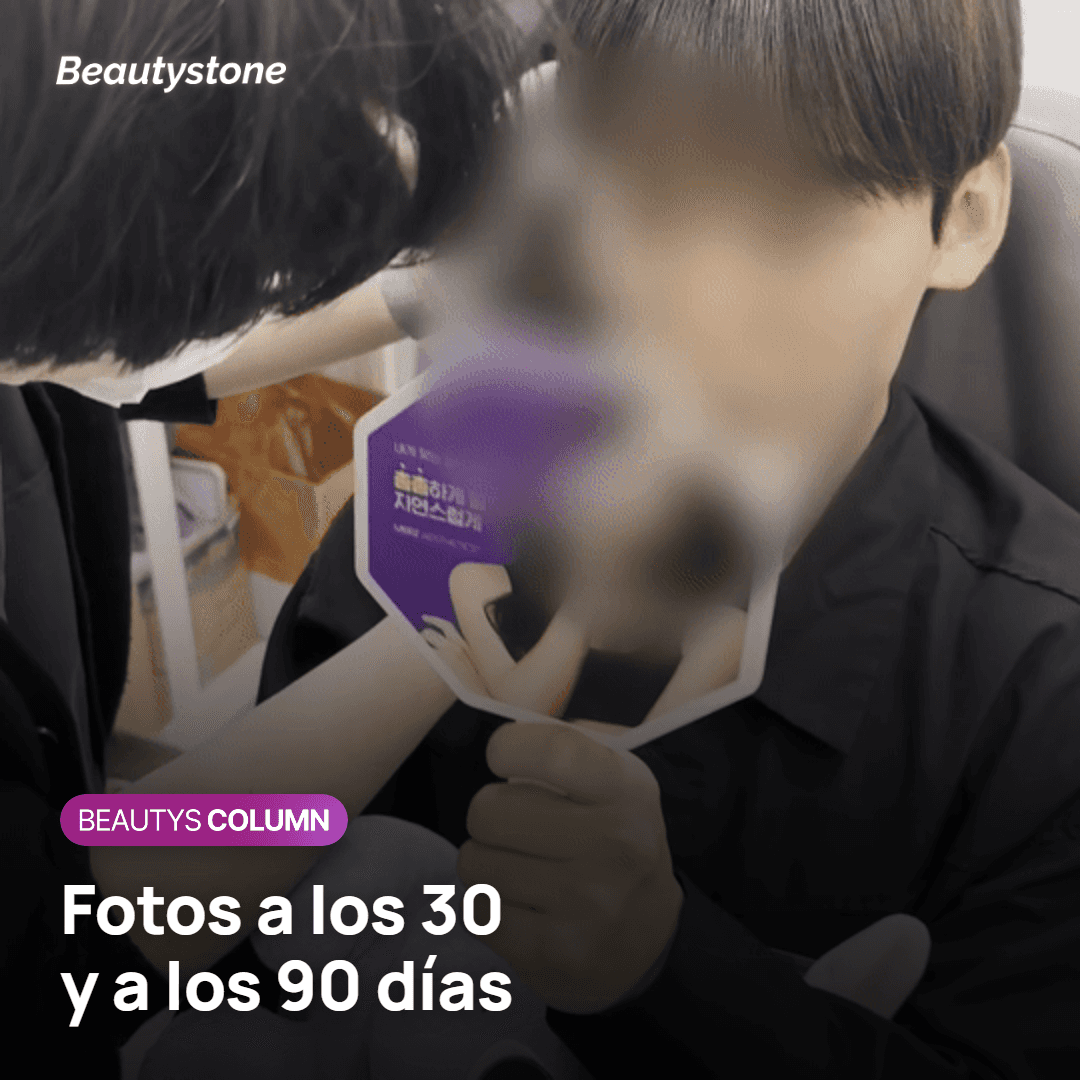 Fotos a los 30 y a los 90 días