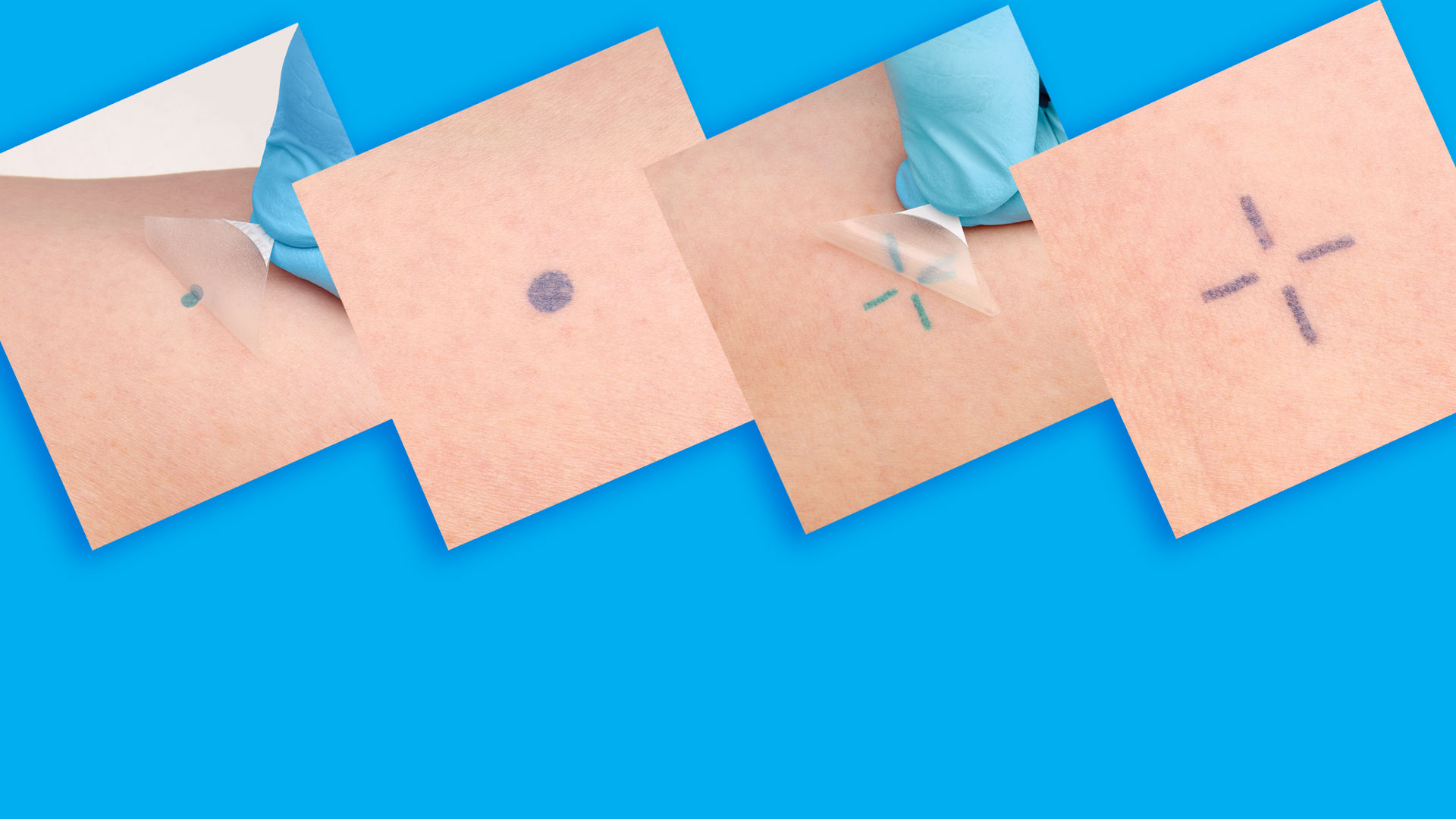 InkRight Banner - InkRight adhered to arm