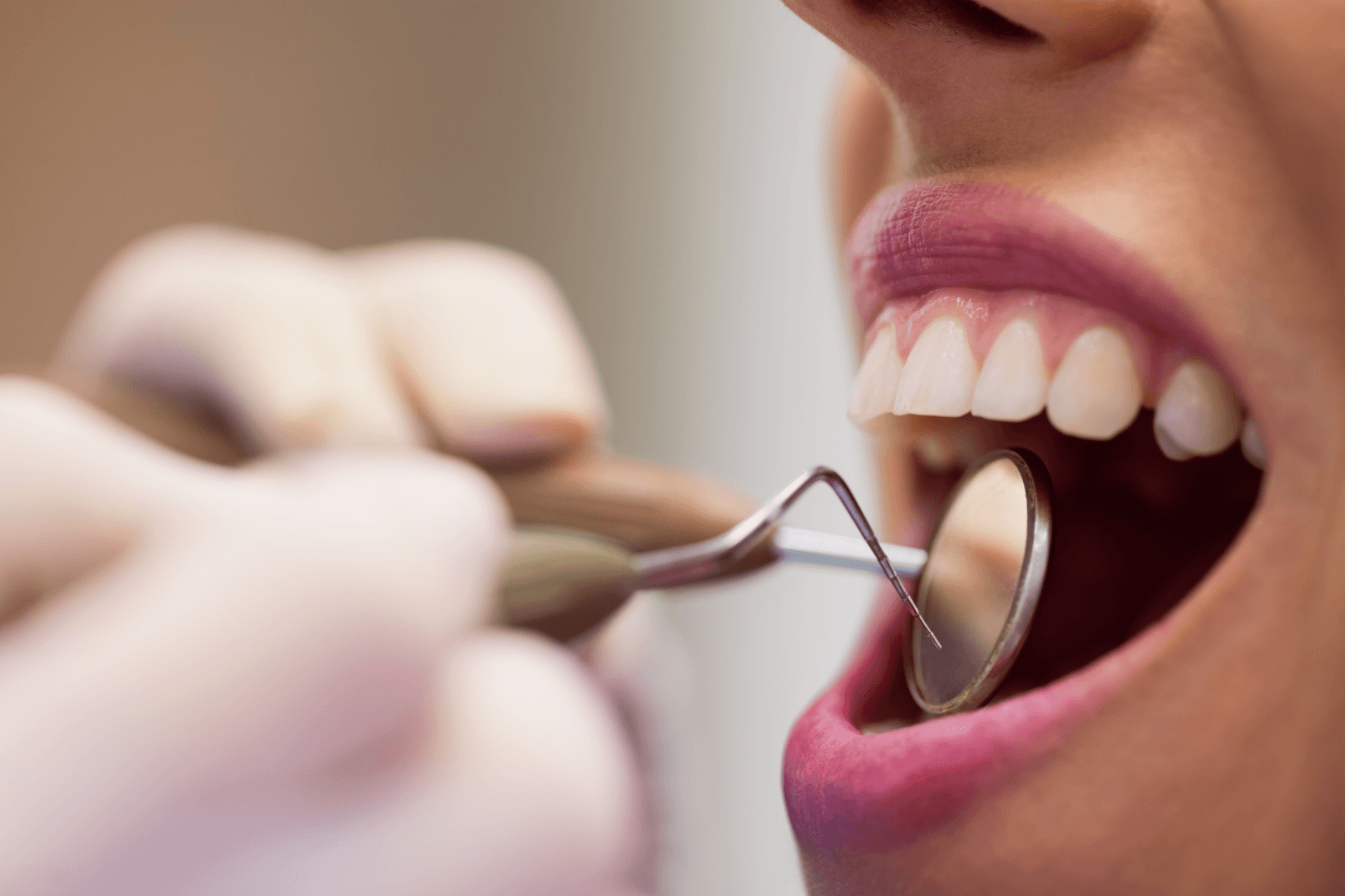 A close-up of a dentist using a dental instrument to examine a patient's teeth.