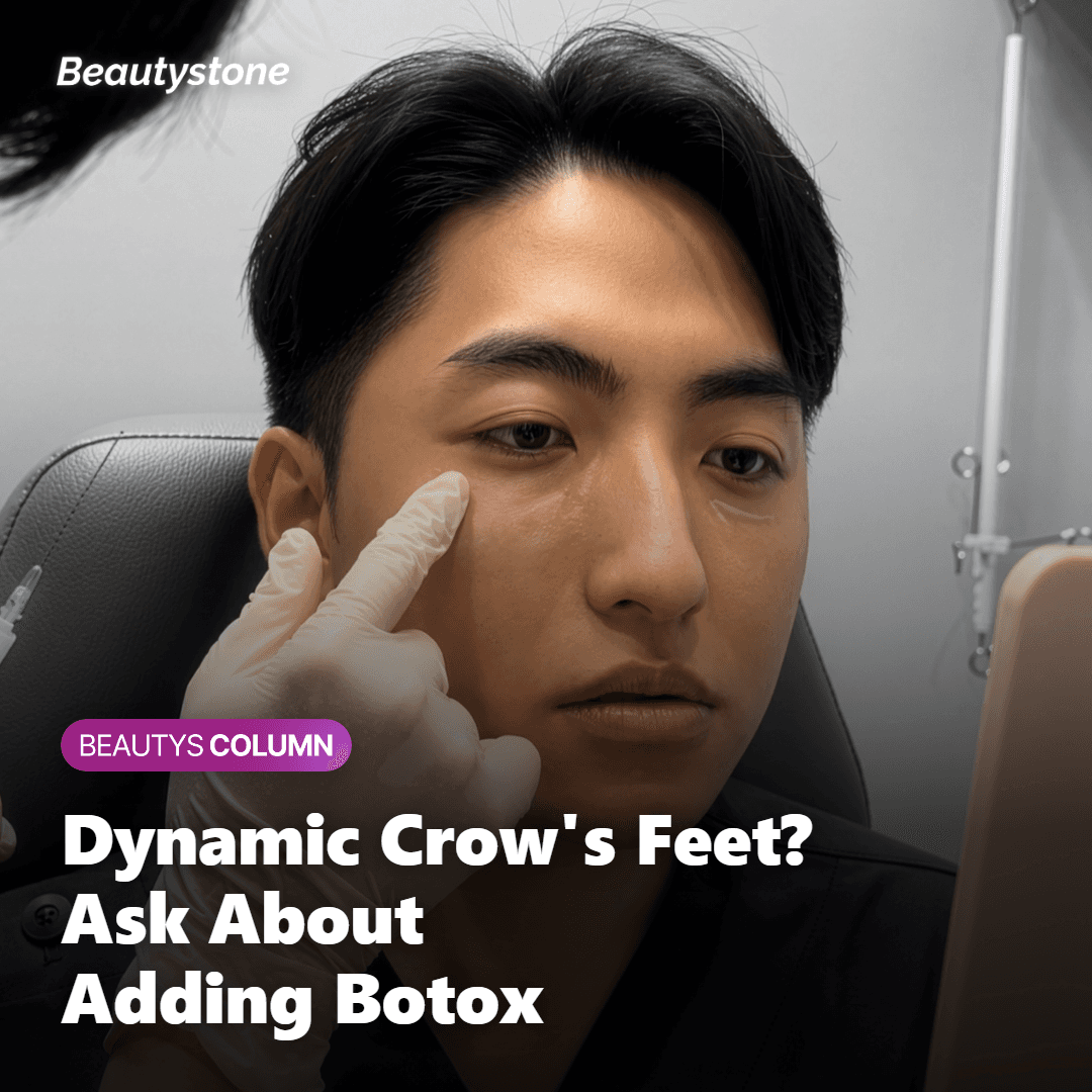 Consultation scene for combining Rejuran HB and Botox for crow's feet treatment