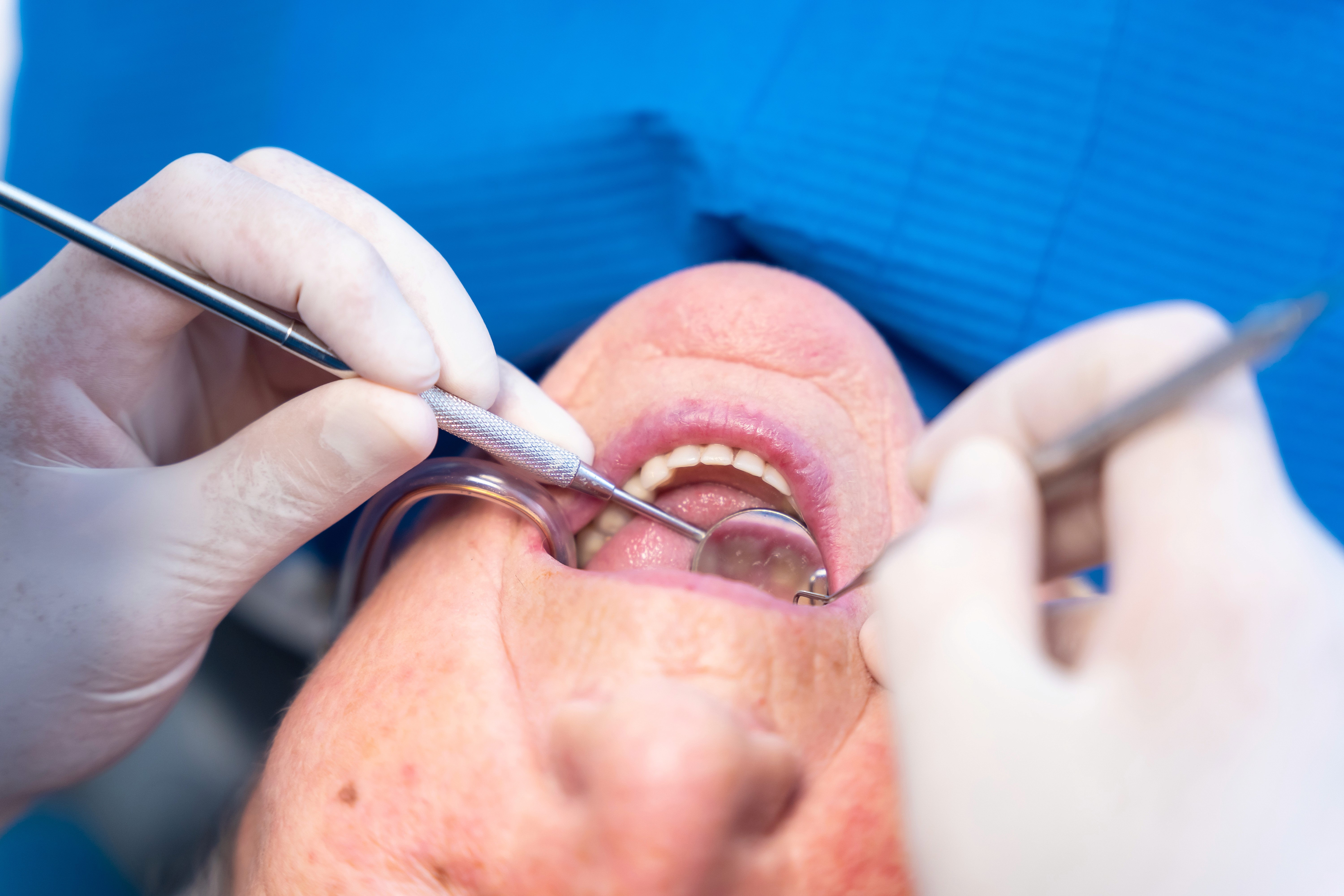 Dentist using tools to look in a patient's mouth