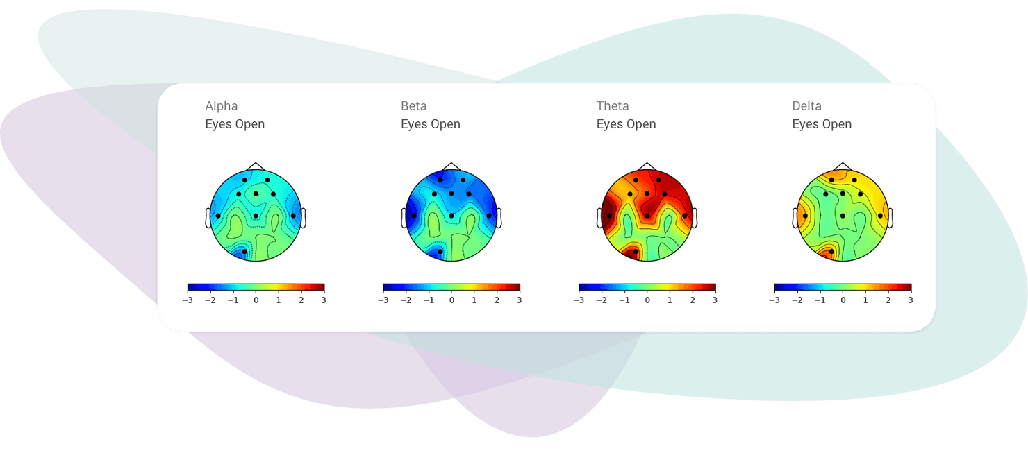 An EEG brain map that was generated by Myndlift. Notice that for each brainwave, there’s a map of the brain where every region is colored differently, with a gradient from blue to red.