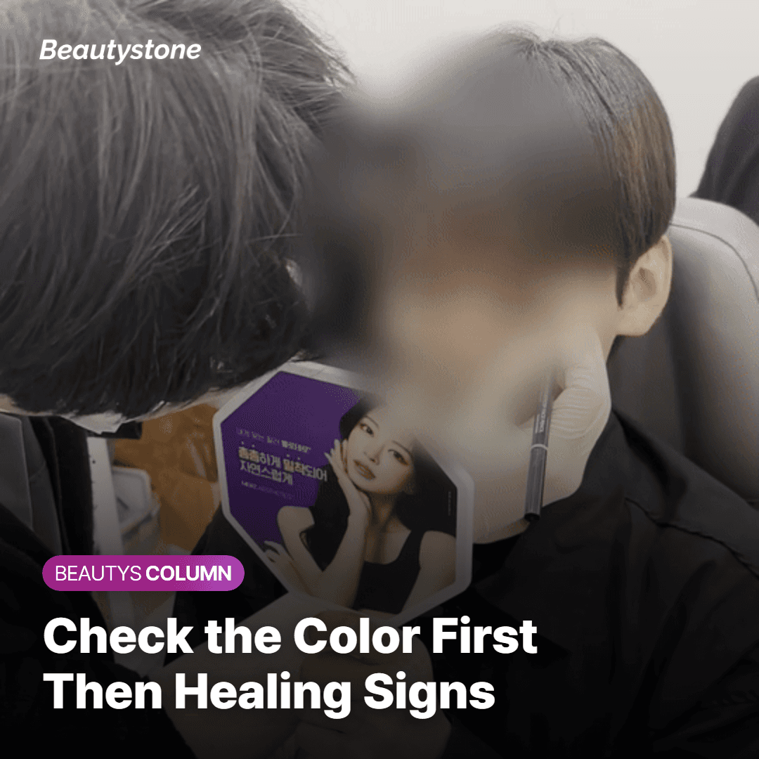 Three things to check before the next tattoo removal session