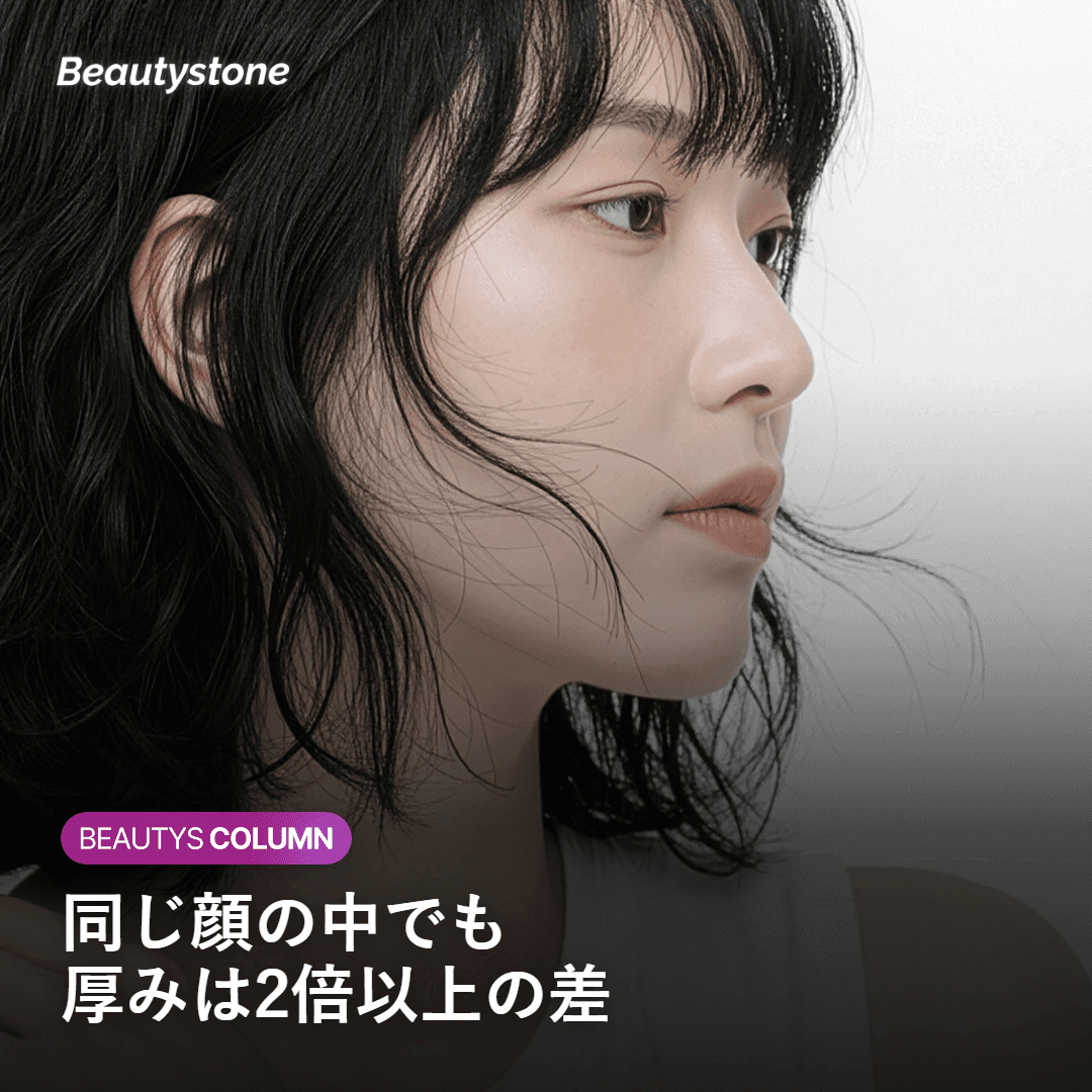 顔の部位によって真皮の厚みが2倍以上変わることを示す比較