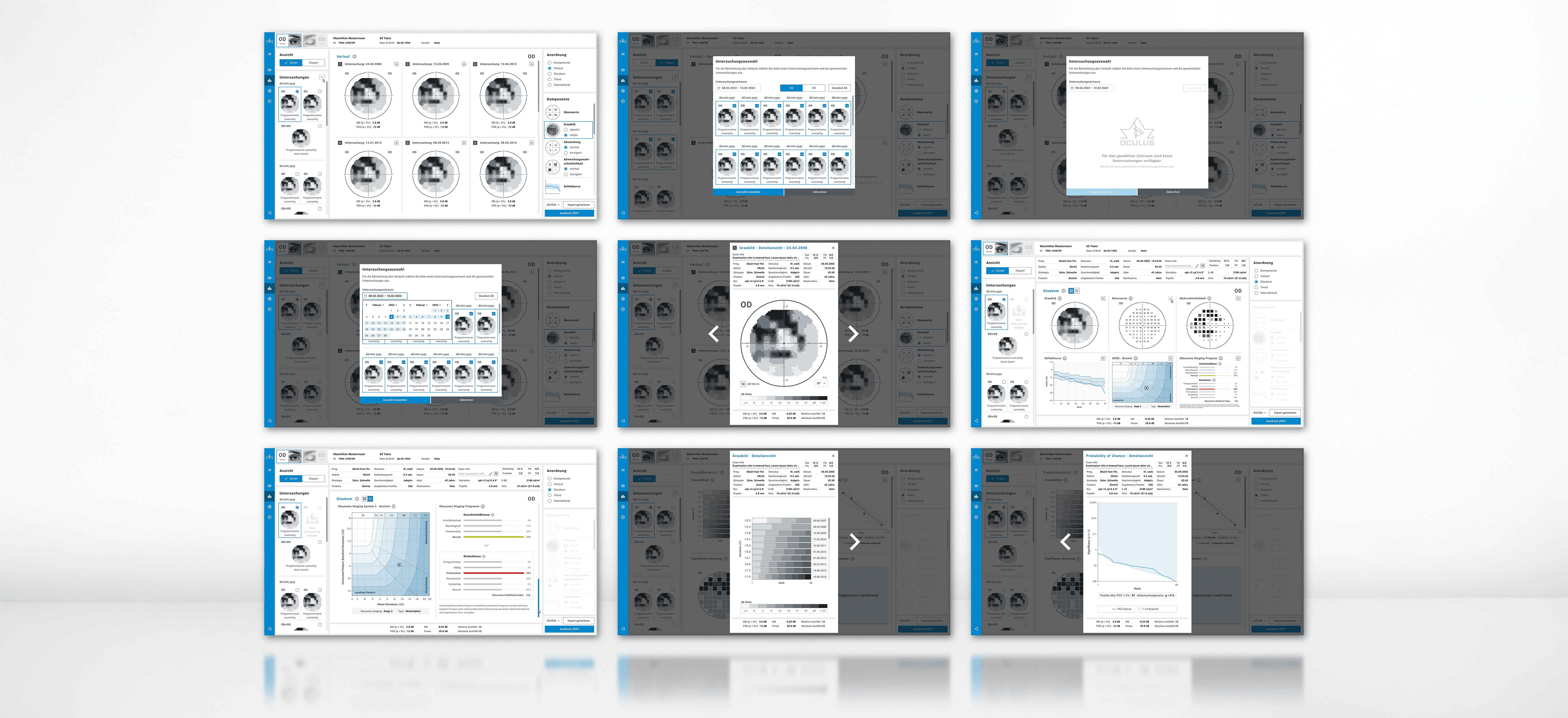 A laptop screen displaying the Pentacam software with various graphics from an eye examination.