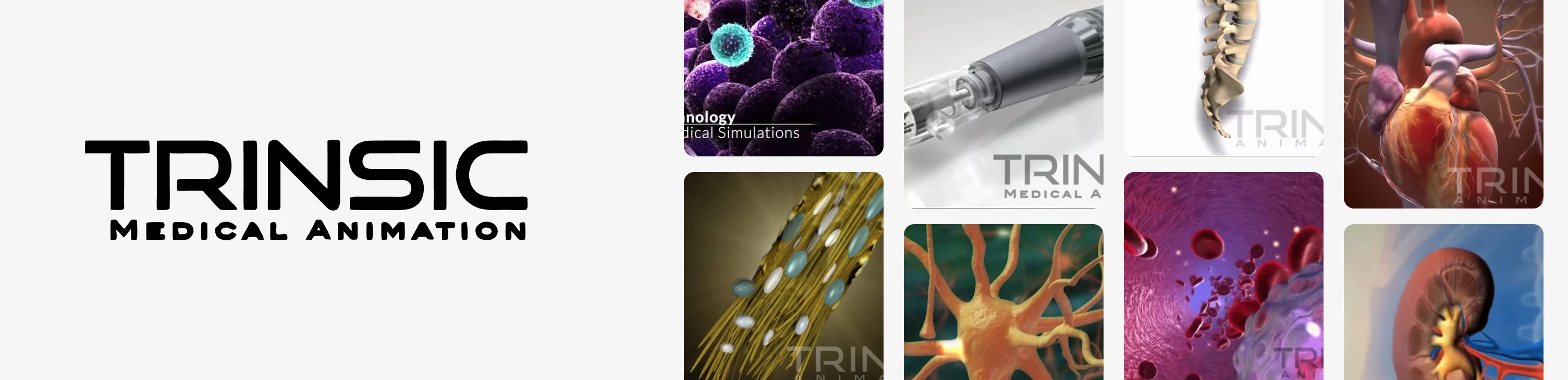 Trinsic Medical Animation logo beside renderings of anatomy, cells, neurons and medical devices.