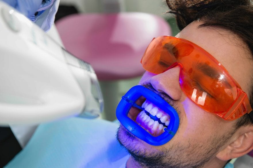 Professional teeth whitening treatment at dental office