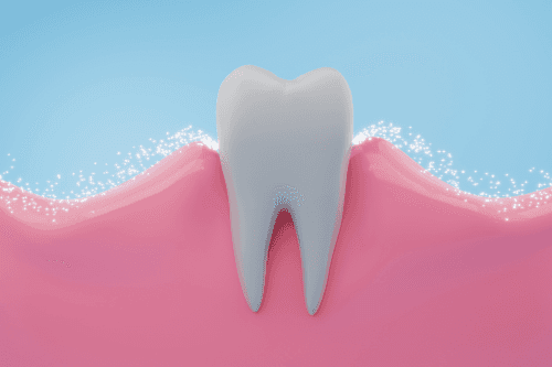 Fluoride Treatment at Sovrle Dental Clinic