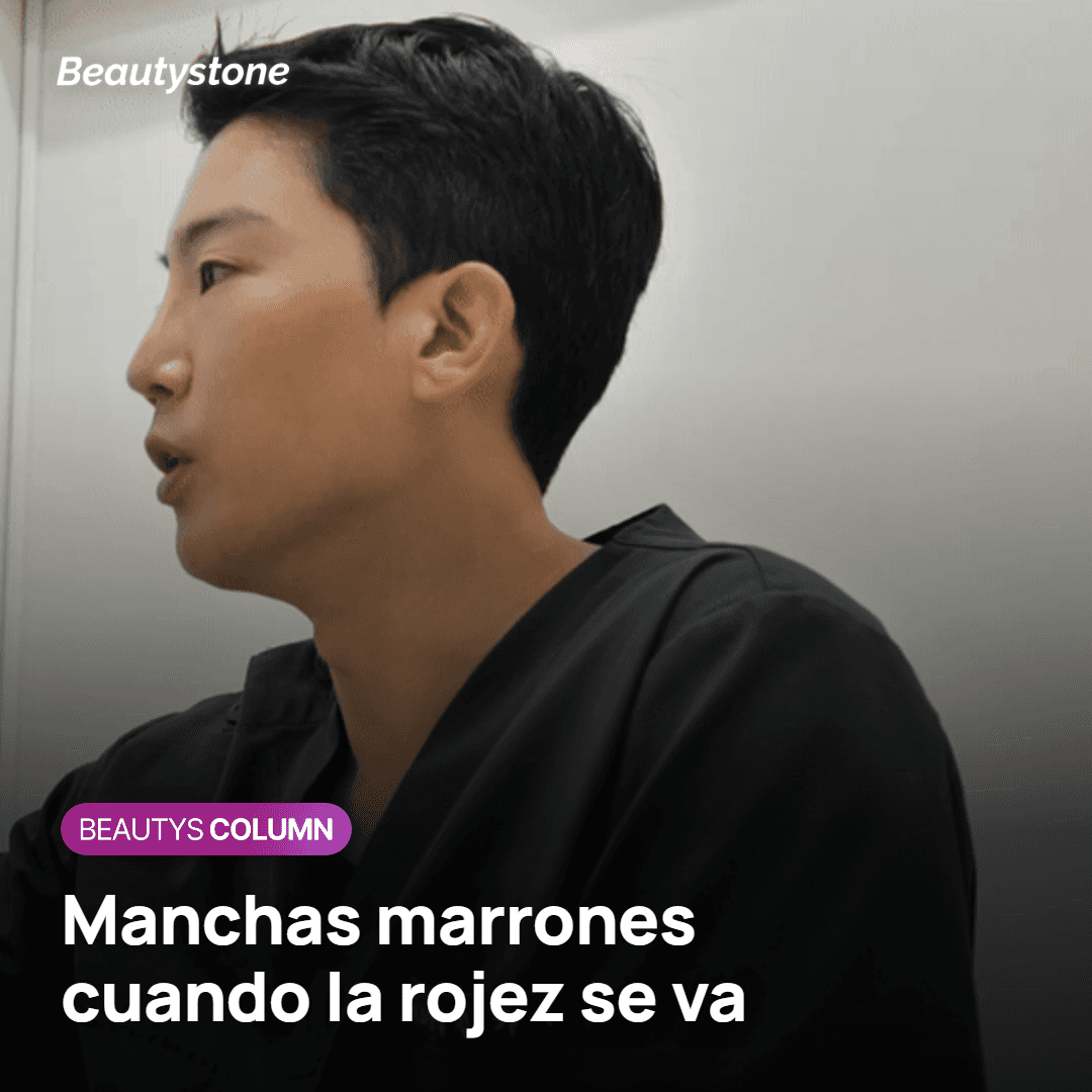 Mancha marrón posinflamatoria en una piel con más melanina tras el láser