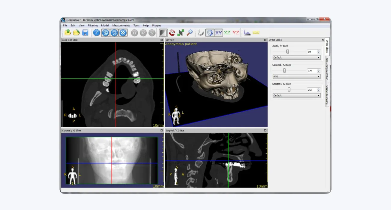 3DimViewer: lightweight 3D DICOM viewer