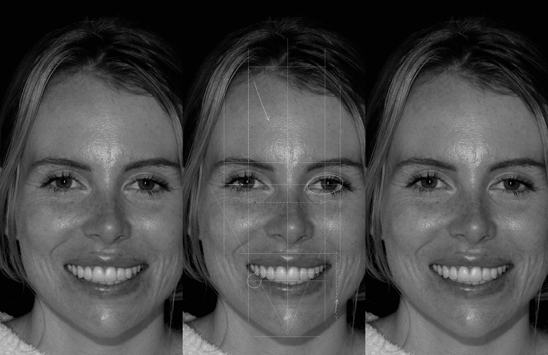 Facial Harmony