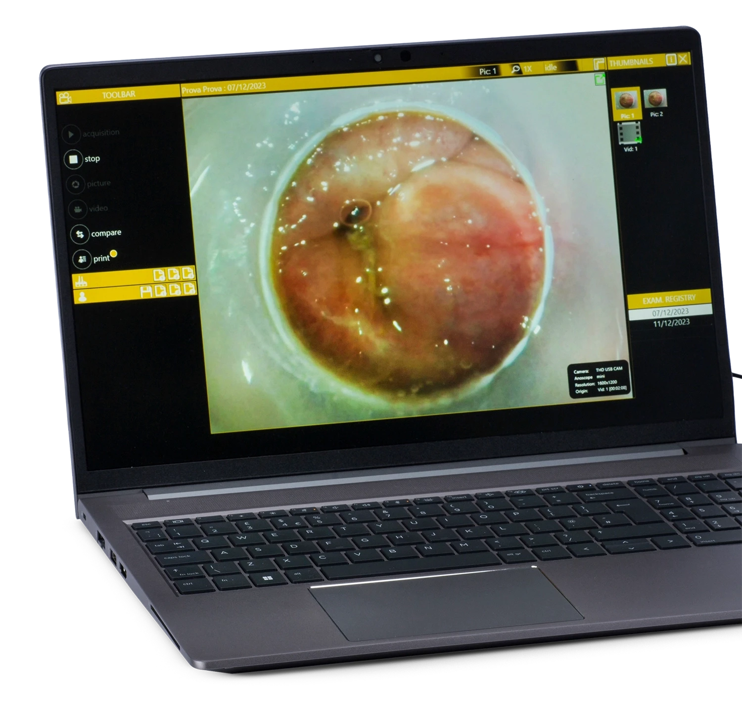 Immagine della Digital Mobile con il modulo di Manometria anorettale