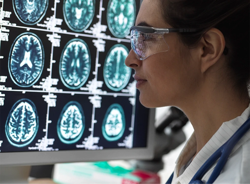 Medical professional reviewing MRI brain images for trauma assessment
