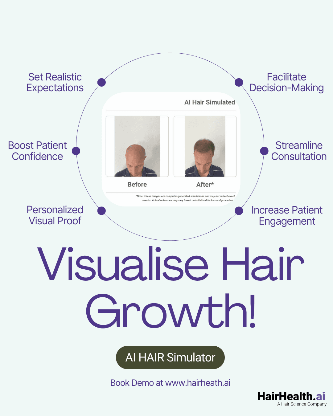 AI hair transplant simulator, hair transplant before and after AI, virtual hair transplant preview, hair transplant simulation tool, AI hair restoration preview, hair transplant results simulator, what will I look like after hair transplant