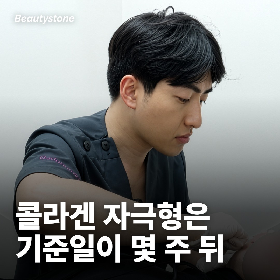 히알루론산과 콜라겐 자극형은 기준 사진 날짜가 달라요