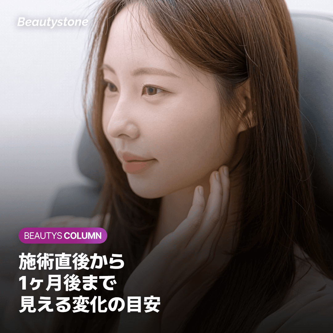 施術直後・1週間後・1ヶ月後に見える変化