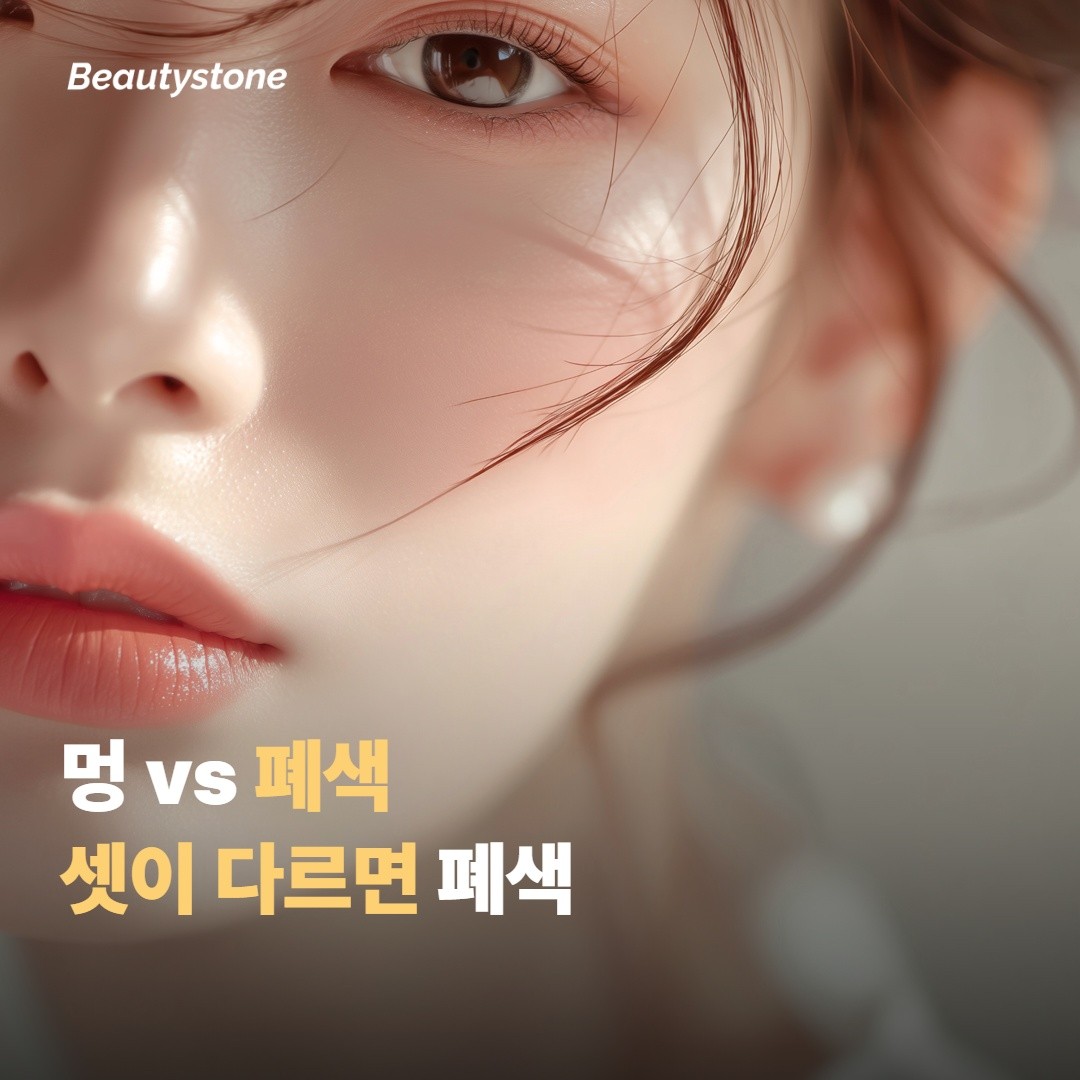 30분 ~ 4시간 — 멍과 폐색 가르기
