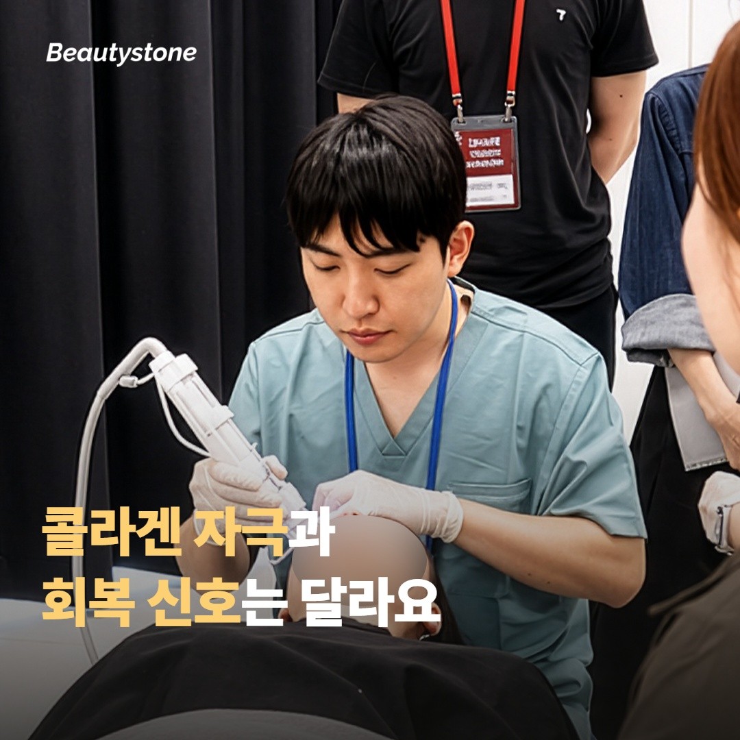지속 기간이 다르게 보이는 이유