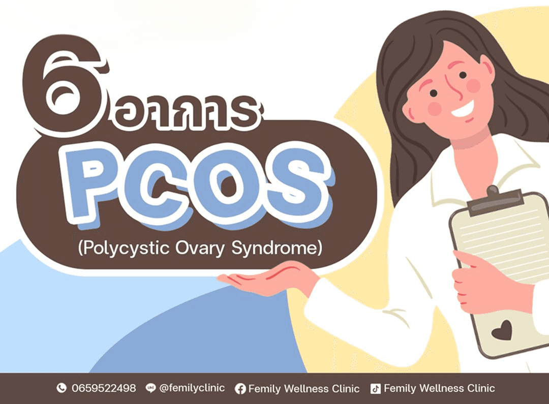 อินโฟกราฟิกให้ความรู้เกี่ยวกับ PCOS แสดงแพทย์ผู้หญิงถือแฟ้มเอกสารพร้อมข้อความ 6 อาการของ PCOS (Polycystic Ovary Syndrome)