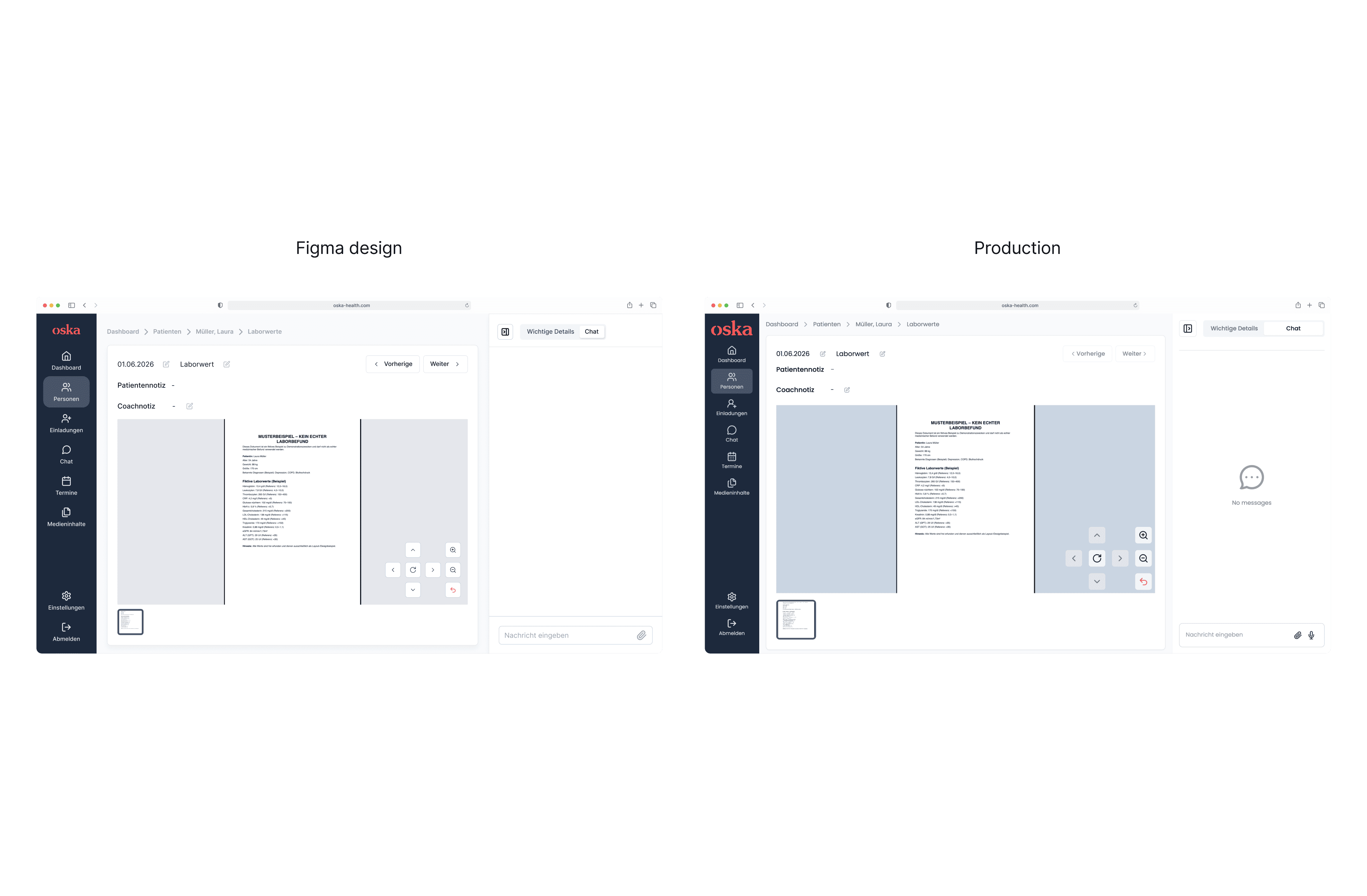 Before and after comparison of Lustery’s global search UI redesign on desktop.