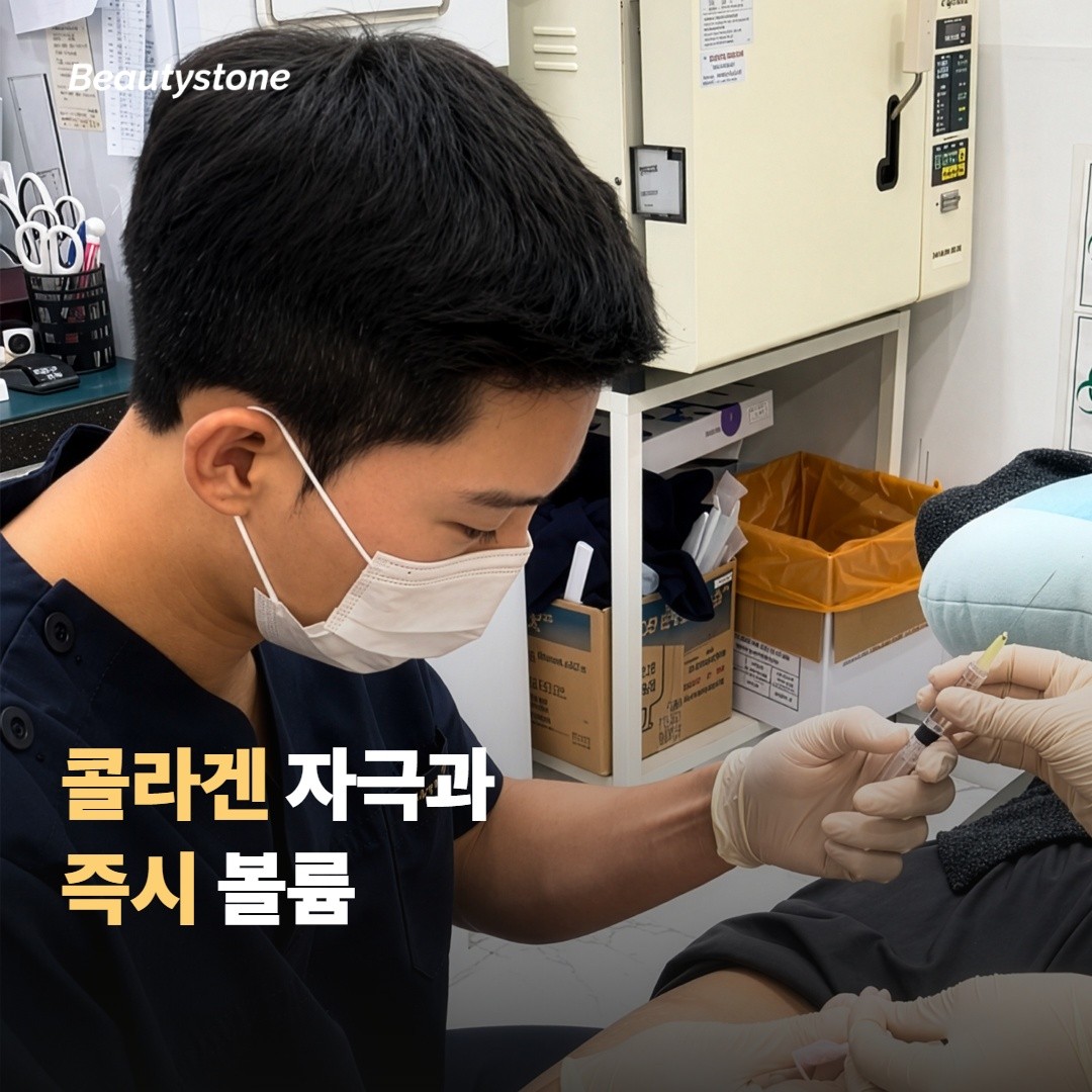 콜라겐 자극과 즉시 볼륨, 두 방식의 차이를 비교해볼게요