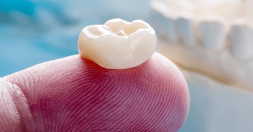 dental crown