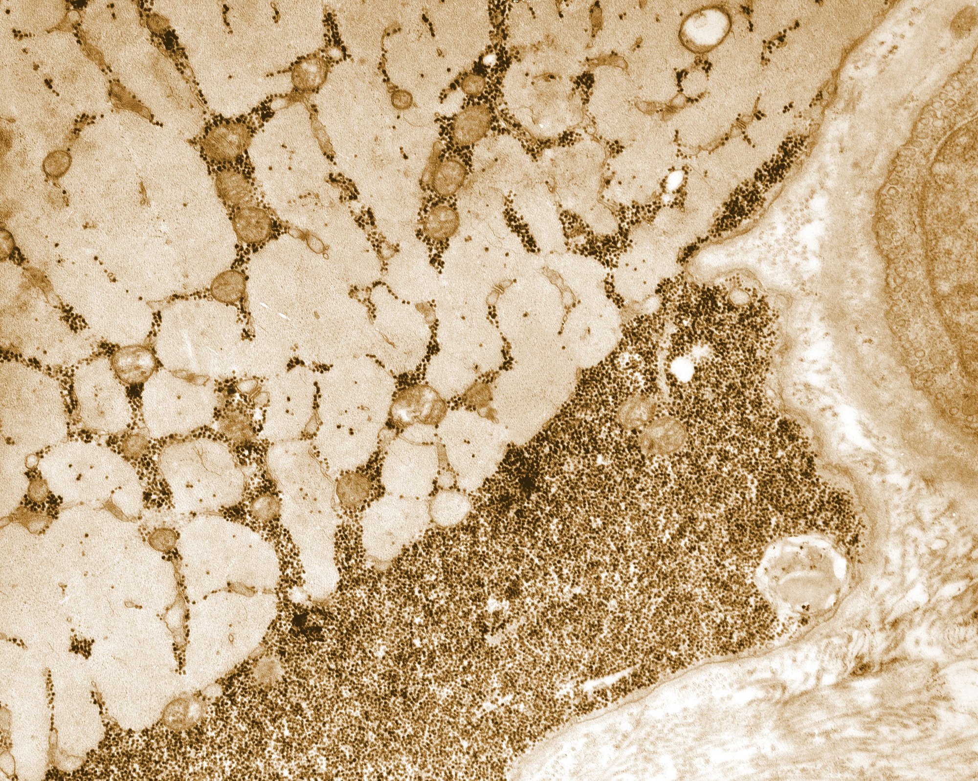 Glycogen granules packed inside a muscle cell, electron micrograph toned amber