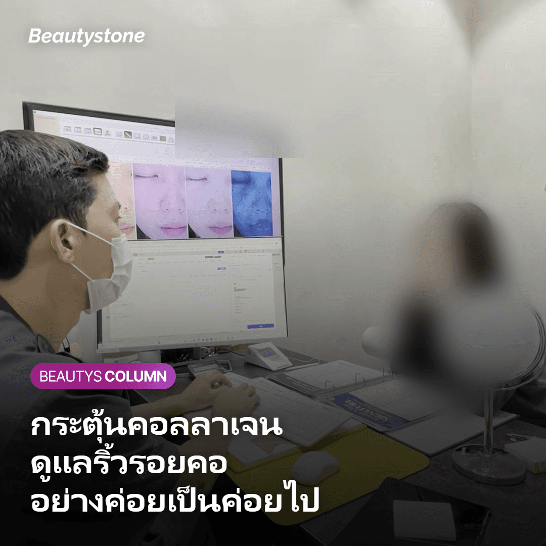 Secret RF ดูแลริ้วรอยคอและความกระชับได้แค่ไหน?