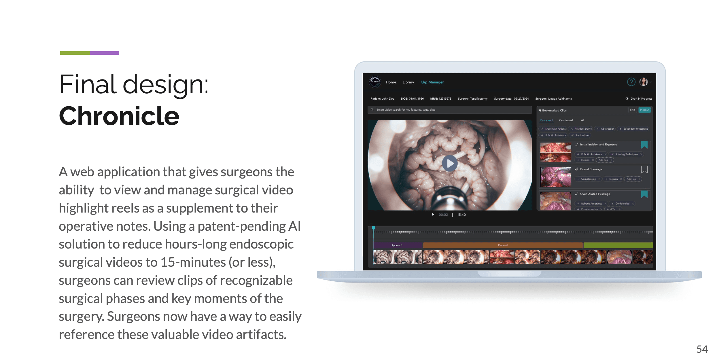 Final high-fidelity Chronicle surgical-video review screen.