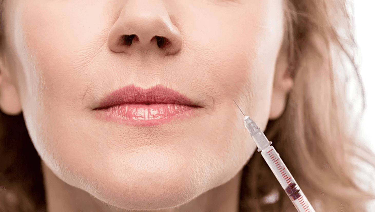 The Best Age to Start Botox for Prevention