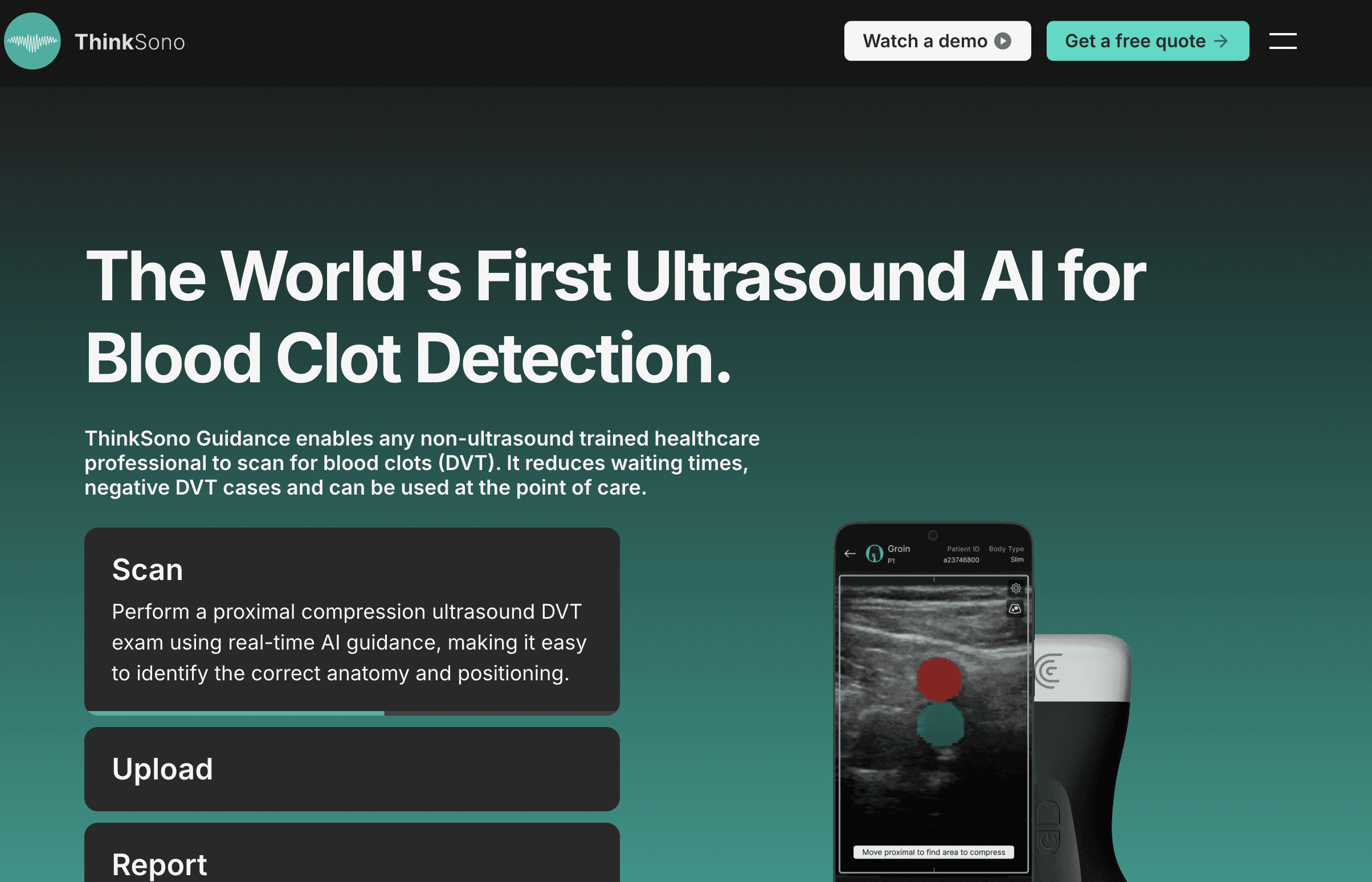 Dvt Detection ThinkSono | AI DVT Detection