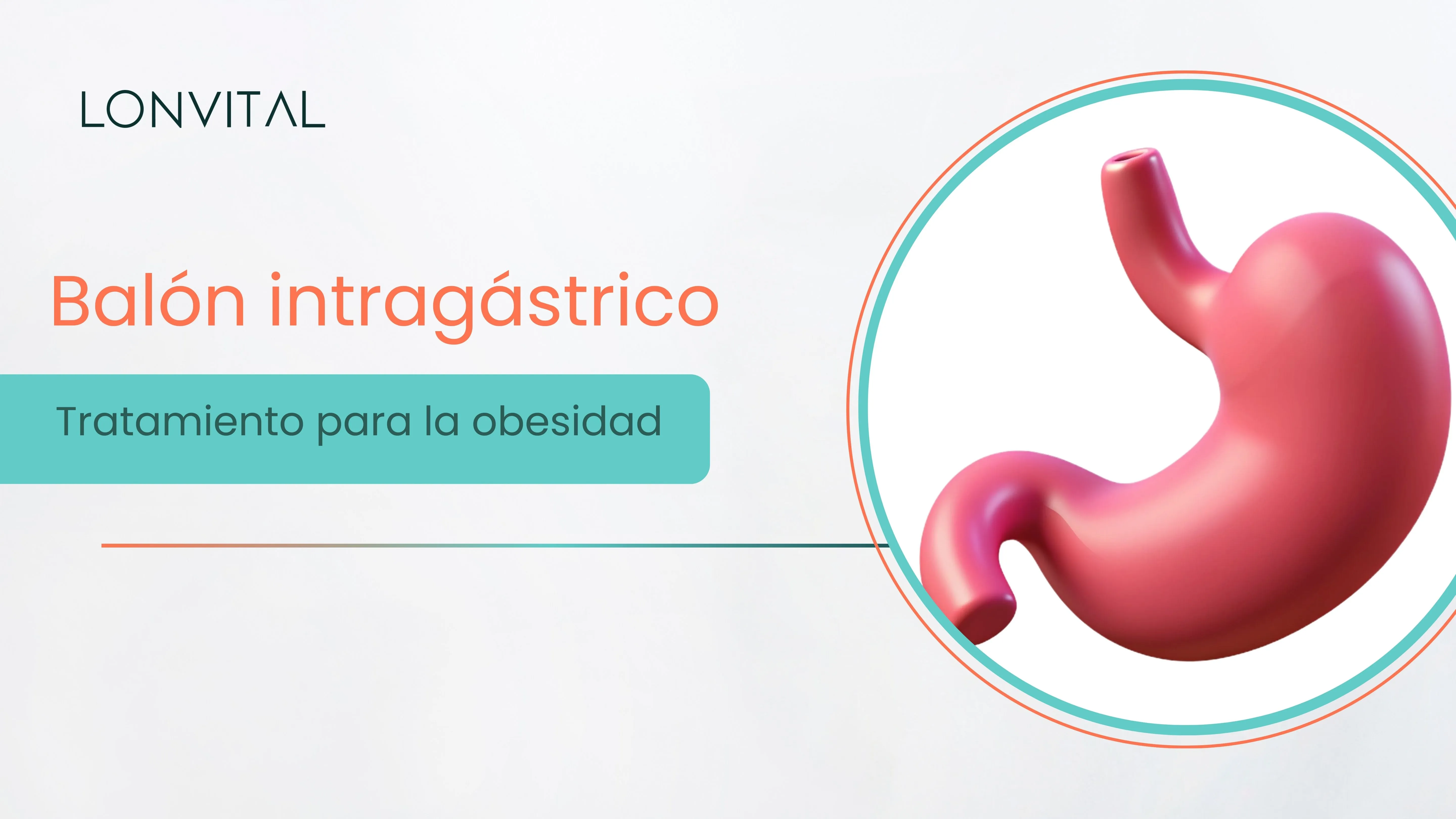 Balón intragástrico: aprende todo lo que necesitas saber sobre este tratamiento para la obesidad