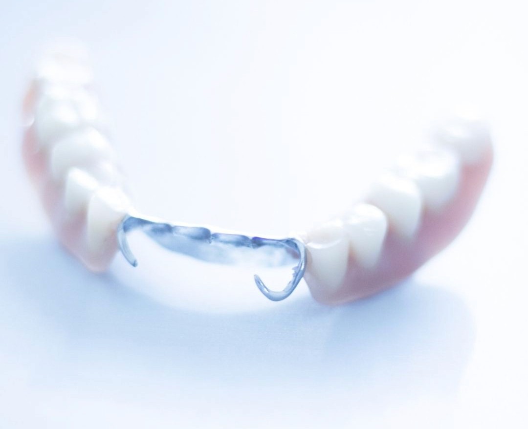 A partial denture from Midtown Dental Studio on Eglinton in Midtown Toronto, Ontario