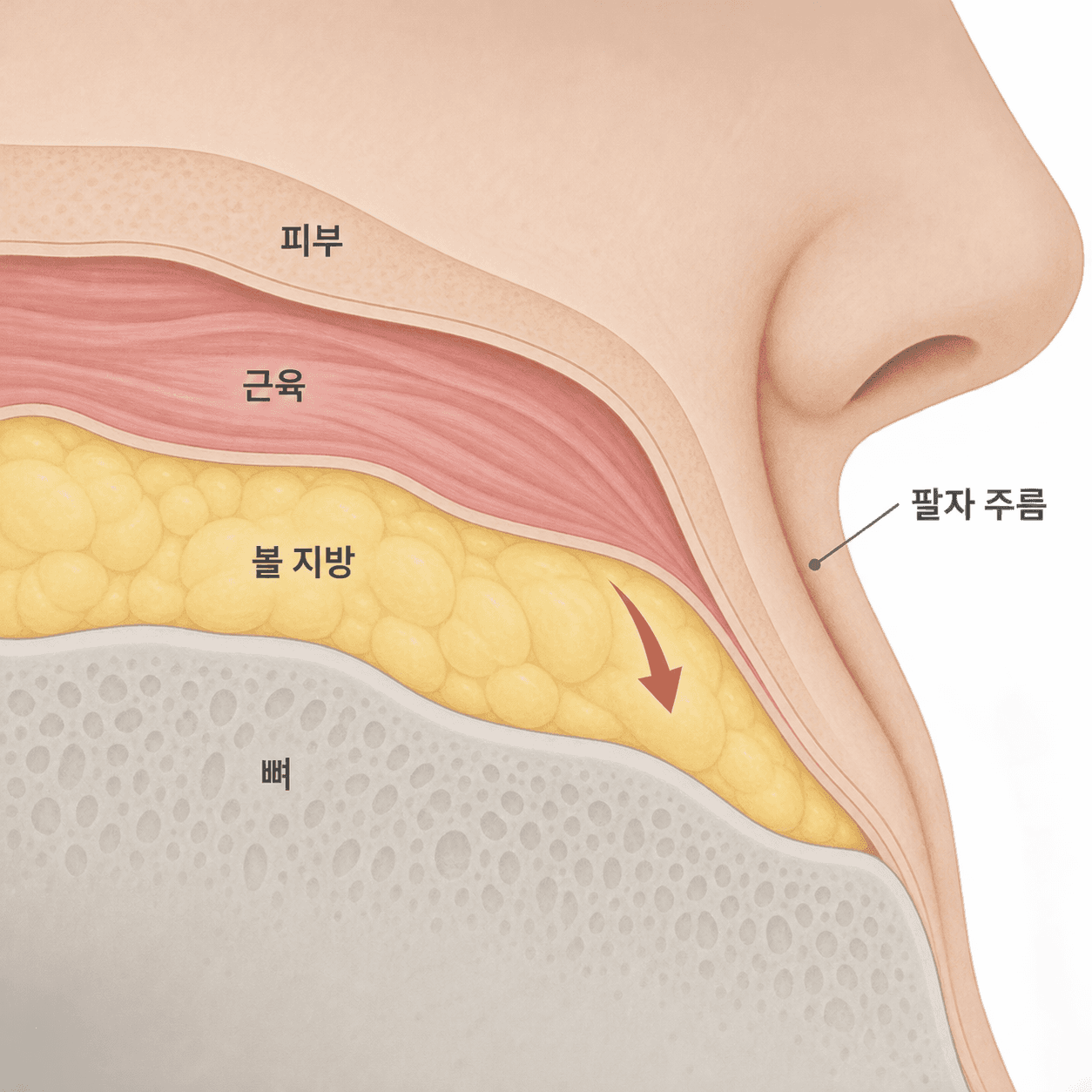 팔자 주름은 피부 아래 뼈 받침과 볼 지방이 줄고 내려오면서 위층이 접혀 생겨요